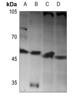 Anti-BMP10 Antibody