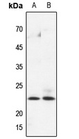 Anti-HPGDS Antibody