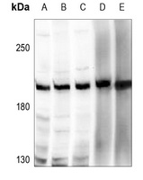 Anti-ZNF638 Antibody