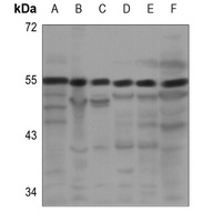 Anti-PRPF19 Antibody