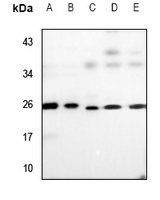 UBE2T antibody