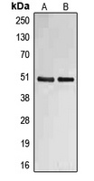 Anti-Fibulin 4 Antibody