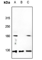 Collagen V antibody