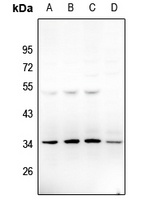 NTM antibody