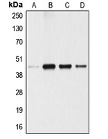 Anti-ANGPTL4 Antibody