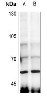 Anti-Angiopoietin-4 Antibody