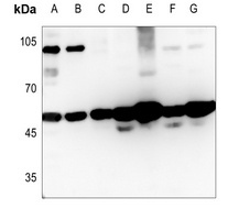 Anti-MAGEC2 Antibody