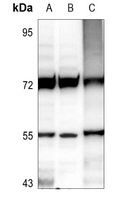 Anti-IP6K2 Antibody