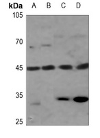 Anti-GPRC5B Antibody