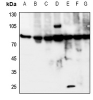 Anti-IL-20RA Antibody