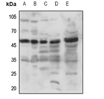 Anti-GPR173 Antibody