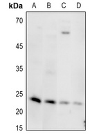 Anti-MED18 Antibody