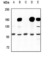 CNNM2 antibody