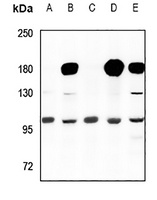 Anti-Cyclin M2 Antibody