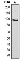 ARHGAP17 antibody