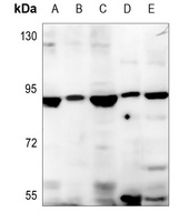 Anti-SBAT1 Antibody