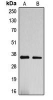 DNAJC17 antibody