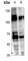 Anti-RCBTB1 Antibody