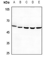Anti-PPP4R1L Antibody