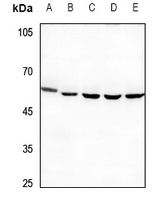 PPP4R1L antibody