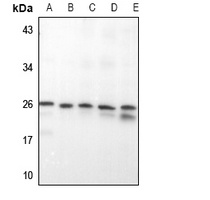 RAB20 antibody