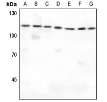 Anti-IARS2 Antibody