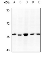 Anti-RCC2 Antibody