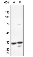 Anti-PMEPA1 Antibody