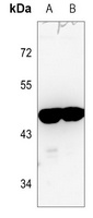 Anti-ARRDC3 Antibody