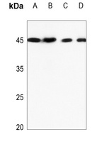 Anti-TRIB3 Antibody