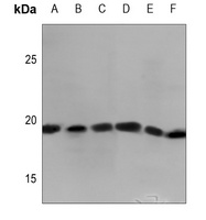 Anti-MYL7 Antibody