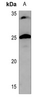 CHP2 antibody