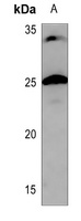 Anti-CHP2 Antibody