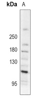 Anti-MDA5 Antibody
