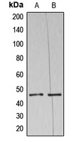 Anti-NAP1 Antibody