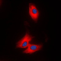 NAP1 Rabbit Polyclonal Antibody