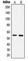 Anti-IPPK Antibody