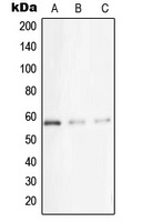 Anti-STK33 Antibody