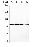 Anti-OTUB2 Antibody