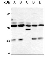 Anti-FTO Antibody
