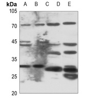 ELOVL6 antibody