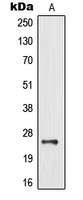 Anti-MOB3B Antibody