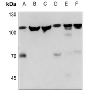 Anti-NAA15 Antibody