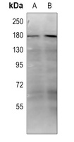 Anti-Collagen 18 alpha 1 Antibody