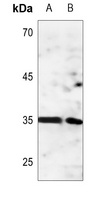 Anti-ANT4 Antibody