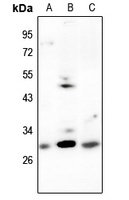 Anti-CDCA3 Antibody