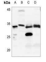 Anti-DNAL1 Antibody