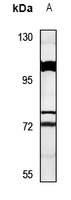 Anti-SYT16 Antibody