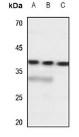 SLC10A7 antibody