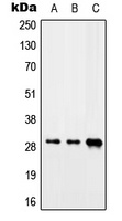 Anti-CIP29 Antibody